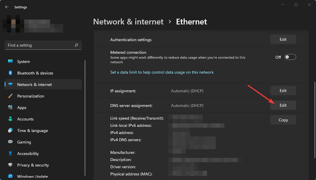 clicking edit dns win11 settings
